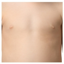Chest