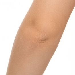 Elbow