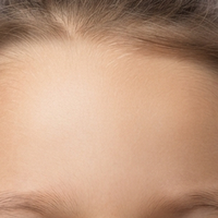Forehead