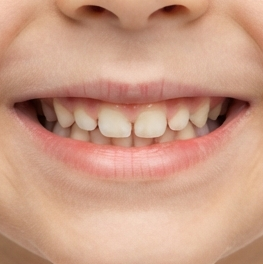 Teeth