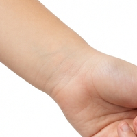 Wrist